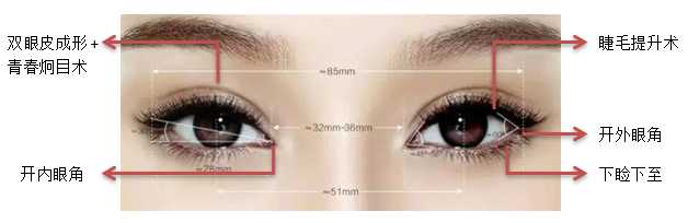 Eyelid Surgery Image