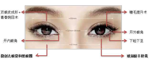 Eyelid Surgery Image