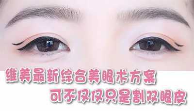 Eyelid Surgery Image