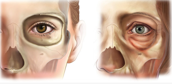 Facial contour fixation and anti-aging