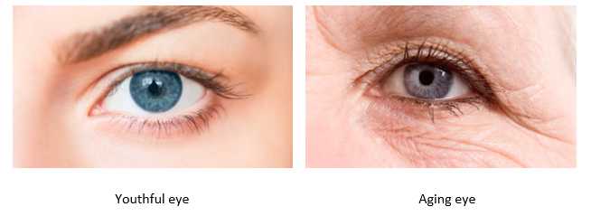 Lower Eyelid Rejuvenation Image