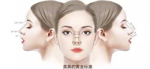 Rhinoplasty Image